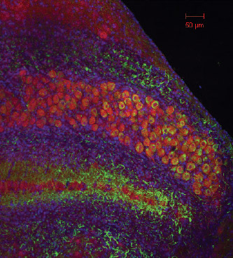 A 25x confocal image of nucleus magnocellularis, the first nuclei to receive auditory input from the ear