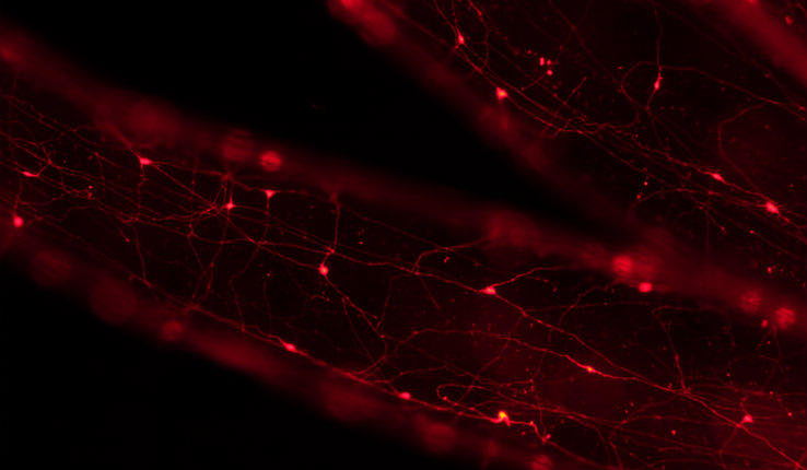 Tentacles of Nematostella with subpopulation of neurons expressing red fluorescent protein
