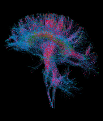 Diffusion MRI of the human brain, purple and pink in color, black background