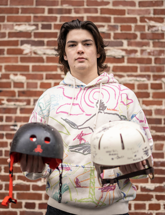 Nic Altenderfer holding a skateboard helmet and his surgery helmet